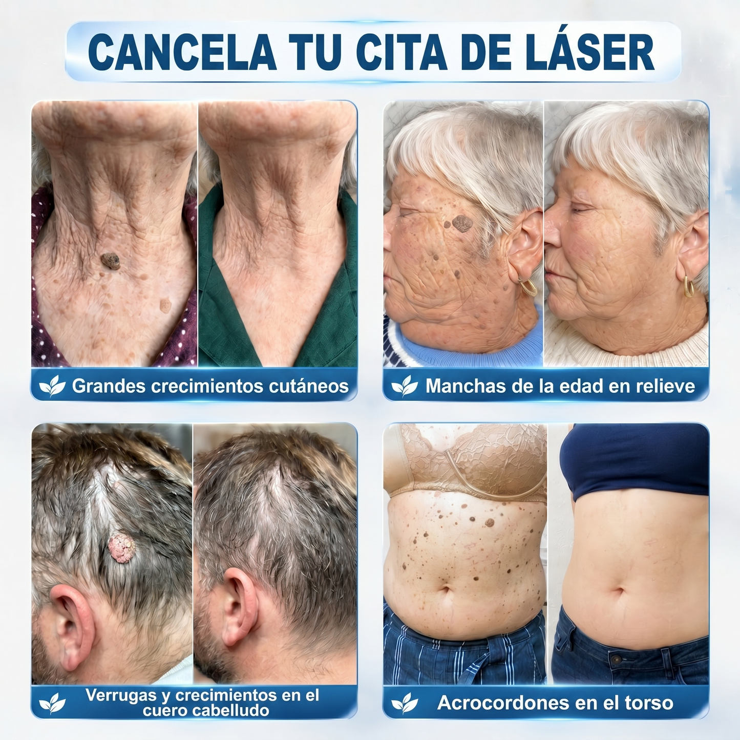 🍠𝐓𝐢𝐞𝐧𝐝𝐚 𝐨𝐟𝐢𝐜𝐢𝐚𝐥 𝐝𝐞 𝐥𝐚 𝐦𝐚𝐫𝐜𝐚  𝐇𝐞𝐚𝐥𝐫𝐢𝐳𝐞® 𝐁𝐨𝐫𝐫𝐚𝐝𝐨𝐫 𝐝𝐞 𝐕𝐞𝐫𝐫𝐮𝐠𝐚𝐬 𝐲 𝐌𝐚𝐧𝐜𝐡𝐚𝐬 𝐝𝐞 𝟕 𝐃í𝐚𝐬(Roll-on Cero Dolor, Cero Cicatrices)