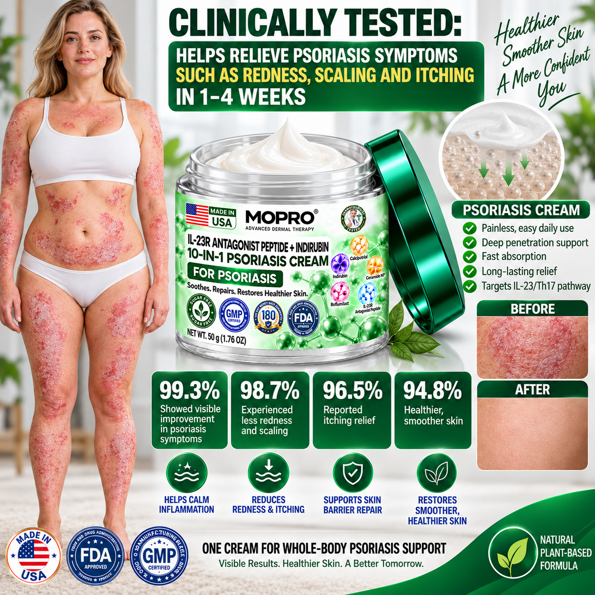 🔥 Only 10 left! Get 30% OFF your second purchase! MOPRO® helps reduce visible scaling, redness, dryness & itching while supporting psoriasis-prone skin. Limited stock — don’t miss out! 💚