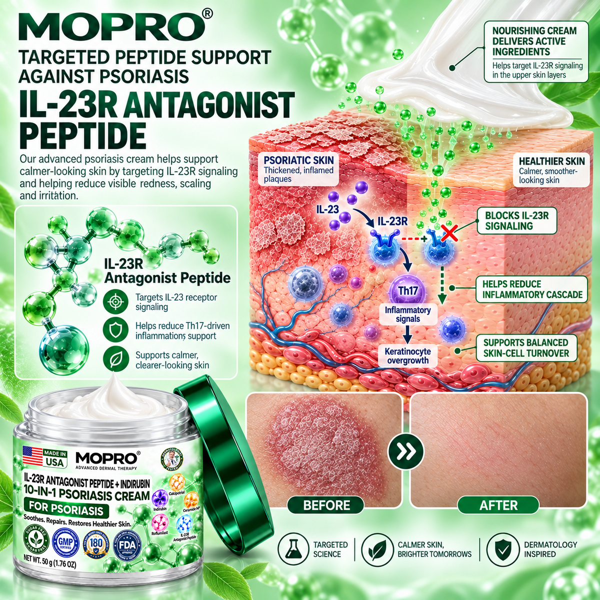 🔥 Only 10 left! Get 30% OFF your second purchase! MOPRO® helps reduce visible scaling, redness, dryness & itching while supporting psoriasis-prone skin. Limited stock — don’t miss out! 💚