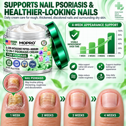 🔥 Only 10 left! Get 30% OFF your second purchase! MOPRO® helps reduce visible scaling, redness, dryness & itching while supporting psoriasis-prone skin. Limited stock — don’t miss out! 💚