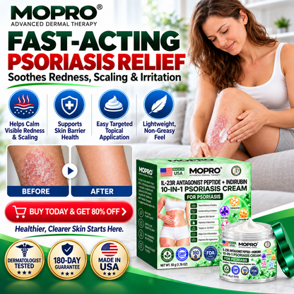 🔥 Only 10 left! Get 30% OFF your second purchase! MOPRO® helps reduce visible scaling, redness, dryness & itching while supporting psoriasis-prone skin. Limited stock — don’t miss out! 💚